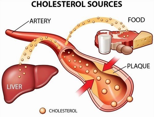 Chỉ số Cholesterol là một thành phần trong máu