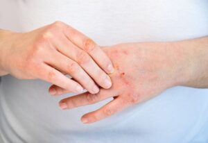 Bôi kem dưỡng là cách làm mịn da tay chân mùa đông hiệu quả nhất
