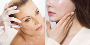 Chỉ thực hiện tiêm Botox và Filler tại các địa chỉ uy tín được cấp phép hoạt động