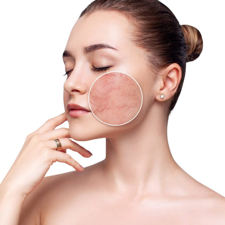 Skincare cho da nhạy cảm – Bí quyết chăm sóc làn da khó chiều