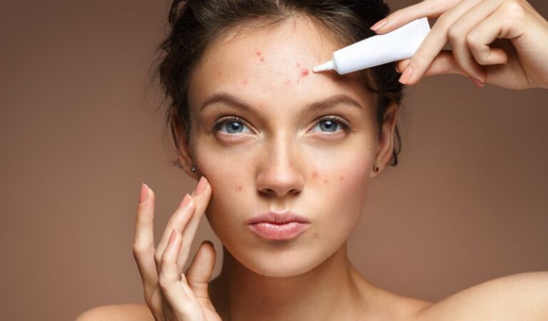 Serum vitamin C trị thâm mụn – Giải pháp cho làn da sáng khỏe