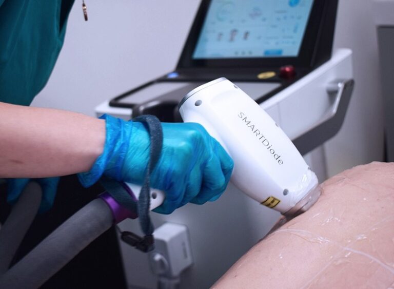 Công nghệ triệt lông Diode Laser là gì? Quy trình thực hiện thế nào?